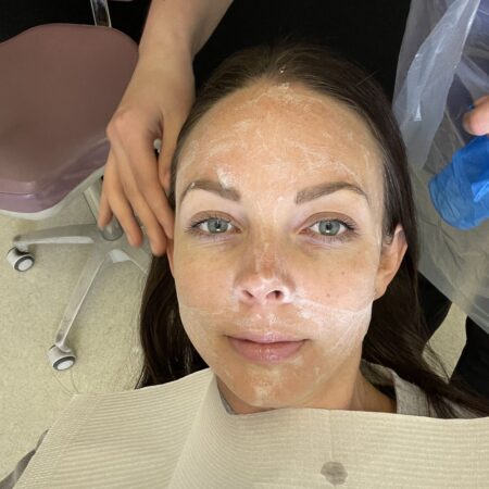 hyperpigmentation treatment